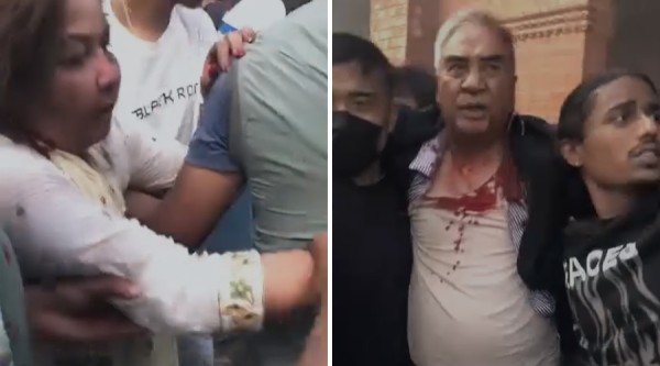 कांग्रेस सभापति देउवा र उहाँकी पत्नी आरजू आन्दोलनकारीको कुटपिटबाट घाइते